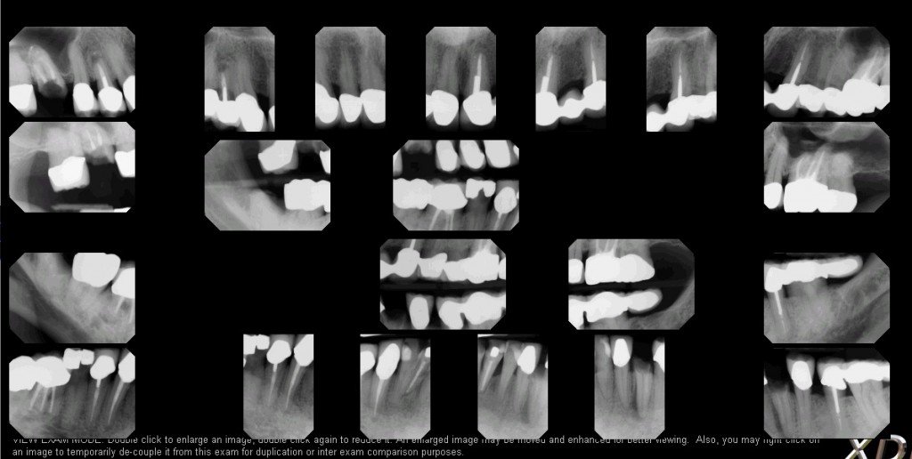fmx International Dentist Central